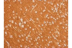 Immunohistochemistry (IHC) image for anti-Amphiphysin (AMPH) (N-Term) antibody (ABIN2855590)