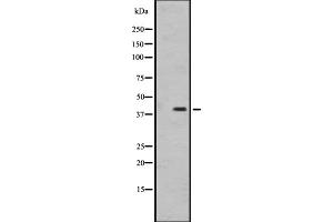 Western blot analysis of OR1I1 expression in MDA-MB231 cell line lysate ,The lane on the left is treated with the antigen-specific peptide. (OR1I1 抗体  (C-Term))