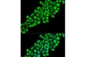 Immunofluorescence analysis of HeLa cells using PON2 Polyclonal Antibody (PON2 抗体)