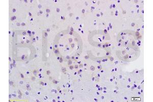Formalin-fixed and paraffin embedded rat brain labeled with Anti-CXCL10 Polyclonal Antibody, Unconjugated (ABIN687442) at 1:200 followed by conjugation to the secondary antibody and DAB staining. (CXCL10 抗体  (AA 35-98))