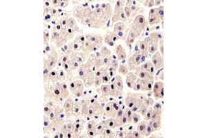 Immunohistochemical analysis of paraffin-embedded H. (ALT 抗体  (N-Term))