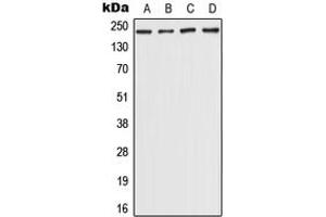 Western blot analysis of CHD5 expression in Hela (A), HepG2 (B), NIH3T3 (C), rat brain (D) whole cell lysates. (CHD5 抗体  (Center))