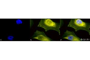 Immunocytochemistry/Immunofluorescence analysis using Rabbit Anti-SOD1 (UBB) Polyclonal Antibody . (SOD1 抗体  (N-Term) (PerCP))