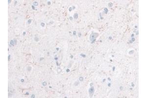 Detection of IL10 in Human Cerebrum Tissue using Monoclonal Antibody to Interleukin 10 (IL10) (IL-10 抗体  (AA 1-178))