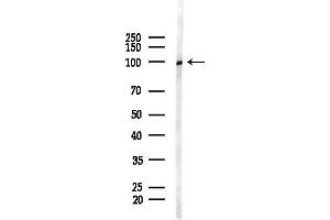Western blot analysis of lysates from COLO205 cells(heat-shock,45 min treatment), using XAB2 Antibody at 1/1000 dilution.