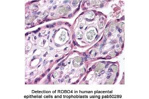Image no. 2 for anti-Roundabout, Axon Guidance Receptor, Homolog 4 (ROBO4) (AA 900-1007), (C-Term) antibody (ABIN363598) (ROBO4 抗体  (C-Term))