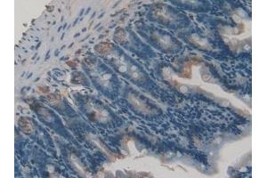 Immunohistochemistry (IHC) image for anti-Gastrokine 2 (GKN2) (AA 21-184) antibody (ABIN7437656)