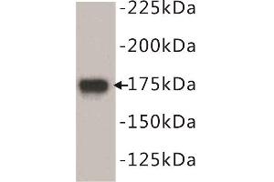 Western Blotting (WB) image for anti-Epidermal Growth Factor Receptor (EGFR) (N-Term) antibody (ABIN1854890) (EGFR 抗体  (N-Term))