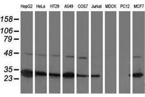 Western blot analysis of extracts (35 µg) from 9 different cell lines by using anti-SPR monoclonal antibody. (SPR 抗体)
