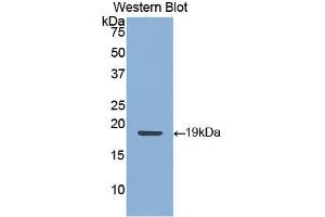 Detection of Recombinant KRT9, Human using Polyclonal Antibody to Cytokeratin 9 (CK9) (KRT9 抗体  (AA 315-456))