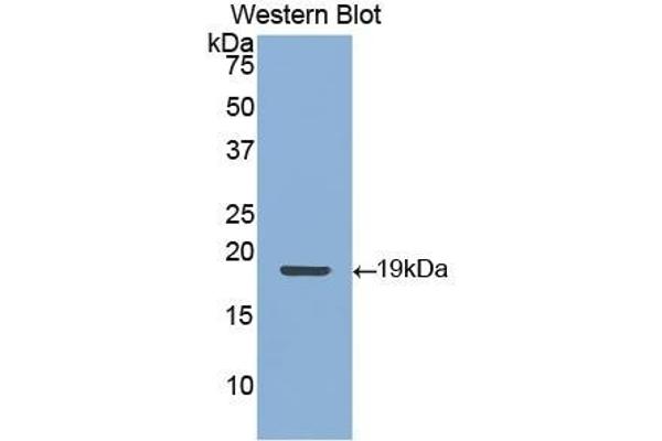 KRT9 抗体  (AA 315-456)