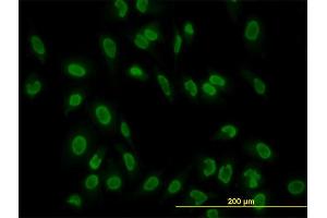 Immunofluorescence of monoclonal antibody to TAF11 on HeLa cell. (TAF11 抗体  (AA 158-210))