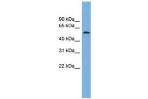Image no. 1 for anti-Glucocorticoid Induced Transcript 1 (GLCCI1) (AA 179-228) antibody (ABIN6744984) (GLCCI1 抗体  (AA 179-228))