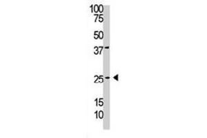 The PDGFB polyclonal antibody  is used in Western blot to detect PDGFC in A-375 cell lysate. (PDGFB 抗体  (C-Term))