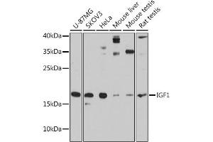 Western blot analysis of extracts of various cell lines, using IGF1 antibody (ABIN6134370, ABIN6142231, ABIN6142233 and ABIN6215544) at 1:3000 dilution. (IGF1 抗体  (AA 50-150))