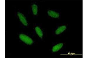 Immunofluorescence of purified MaxPab antibody to ZIM2 on HepG2 cell. (ZIM2 抗体  (AA 1-527))