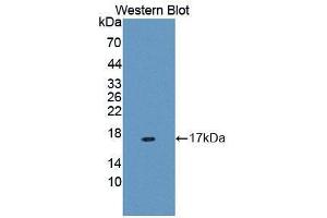 Western blot analysis of the recombinant protein. (MUC5B 抗体  (AA 5366-5444))