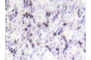 Immunohistochemistry analyzes of CREB antibody in paraffin-embedded human tonsil tissue. (CREB1 抗体)