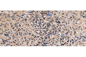 Immunohistochemistry of paraffin-embedded Human brain tissue using ITIH2 Polyclonal Antibody at dilution of 1:70(x200) (ITIH2 抗体)