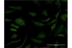 Immunofluorescence of monoclonal antibody to SFN on HeLa cell. (14-3-3 sigma/SFN 抗体  (AA 1-248))