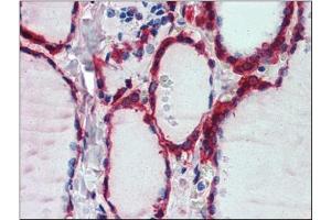 Immunohistochemistry: Human Thyroid: Formalin-Fixed, Paraffin-Embedded (FFPE) (Peroxiredoxin 1 抗体  (Internal Region))