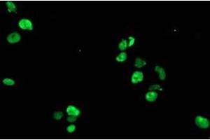 Anti-GTF2F1 mouse monoclonal antibody (ABIN2454913) immunofluorescent staining of COS7 cells transiently transfected by pCMV6-ENTRY GTF2F1 (RC201294). (GTF2F1 抗体)
