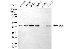 Western blotting analysis using LCK antibody (ABIN7799296).