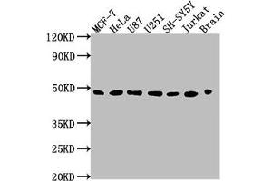Western Blot Positive WB detected in: MCF-7 whole cell lysate, HeLa whole cell lysate, U87 whole cell lysate, U251 whole cell lysate, SH-SY5Y whole cell lysate, Jurkat whole cell lysate, Rat brain tissue All lanes: LOX antibody at 1:2000 Secondary Goat polyclonal to rabbit IgG at 1/50000 dilution Predicted band size: 47 kDa Observed band size: 47 kDa (LOX 抗体  (AA 23-285))