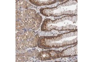 Immunohistochemical staining of human stomach with FBXO43 polyclonal antibody  shows distinct cytoplasmic positivity in glandular cells.