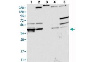 Western blot analysis of Lane 1: RT-4, Lane 2: U-251 MG, Lane 3: Human Plasma, Lane 4: Liver, Lane 5: Tonsil with AGPAT9 polyclonal antibody . (AGPAT9 抗体)