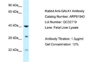 Western Blotting (WB) image for anti-Galactokinase 1 (GALK1) (C-Term) antibody (ABIN786519) (GALK1 抗体  (C-Term))