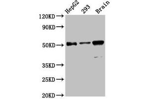 Western Blot Positive WB detected in: HepG2 whole cell lysate, 293 whole cell lysate, Mouse brain tissue All lanes: ZFP57 antibody at 13. (ZFP57 抗体  (AA 183-295))
