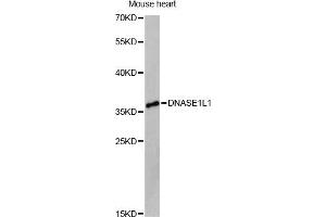 Western blot analysis of extracts of mouse heart, using DNASE1L1 Antibody (ABIN6292459) at 1:3000 dilution. (DNASEX 抗体)