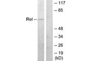 Western blot analysis of extracts from MDA-MB-435 cells, using Rel (Ab-503) Antibody. (c-Rel 抗体  (AA 470-519))