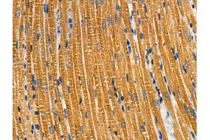 ABIN6259163 and ABIN6274159 at 1/100 staining Rat heart tissue by IHC-P.