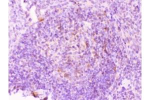 IHC testing of FFPE rat spleen tissue with MMP11 antibody at 1ug/ml. (MMP11 抗体  (AA 104-135))