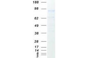 Validation with Western Blot (Integrin beta 3 Protein (ITGB3) (Myc-DYKDDDDK Tag))