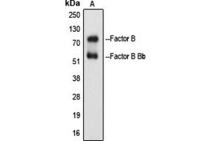 Western blot analysis of Factor B Bb expression in Raji Etoposide-treated (A) whole cell lysates. (Complement B + Bb (Center) 抗体)