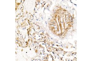 Immunohistochemistry of paraffin-embedded human lung using BST2 Rabbit pAb (ABIN6129547, ABIN6137673, ABIN6137675 and ABIN6215924) at dilution of 1:100 (40x lens). (BST2 抗体  (AA 49-161))