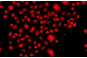 Immunofluorescence analysis of A549 cells using FANCM Polyclonal Antibody (FANCM 抗体)