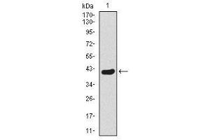 Image no. 1 for anti-Twist Homolog 1 (Drosophila) (TWIST1) antibody (ABIN1491700) (TWIST1 抗体)