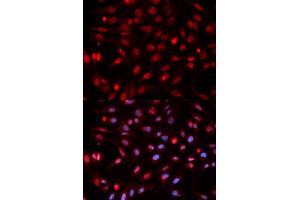 Immunofluorescence analysis of HeLa cell using APEX1 antibody. (APEX1 抗体)