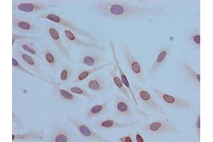 Immunocytochemistry analysis of Hela cells using ABIN7139153 at dilution of 1:100 (HIST1H4A 抗体  (acLys12))