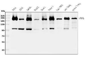 Western blot analysis of Periplakin using anti-Periplakin antibody (ABIN5518787).