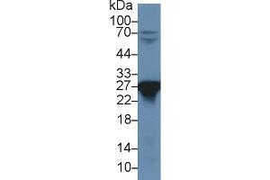 Western blot analysis of Rat Liver lysate, using Rat PRDX6 Antibody (1 µg/ml) and HRP-conjugated Goat Anti-Rabbit antibody (