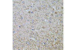 Immunohistochemistry of paraffin-embedded mouse brain using TEFM antibody. (TEFM 抗体  (AA 36-210))