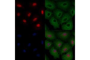 ABIN6263605 and ABIN6276415 staining  cells by IF/ICC.