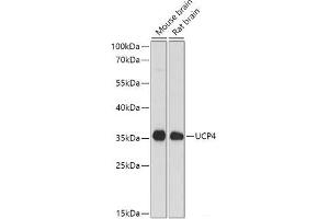 Western blot analysis of extracts of various cell lines using SLC25A27 Polyclonal Antibody at dilution of 1:1000. (SLC25A27 抗体)