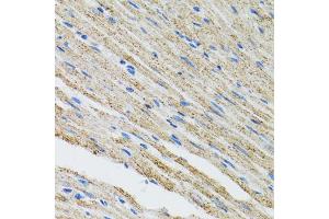 Immunohistochemistry of paraffin-embedded mouse heart using MYOT antibody (ABIN5973839) at dilution of 1/100 (40x lens). (Myotilin 抗体)