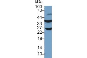 Detection of GAPDH in Human Liver lysate using Polyclonal Antibody to Glyceraldehyde-3-Phosphate Dehydrogenase (GAPDH) (GAPDH 抗体  (AA 154-324))